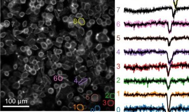 Ученые раскрыли «электрический язык» клеток рака молочной железы
