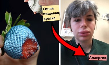40 редких видов аллергий, которые вас удивят