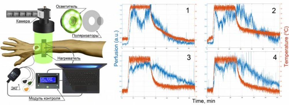 Схема ВФПГ-системы для оценки перфузии крови во время гипертермического теста и экспериментальные зависимости, полученные для четырёх исследуемых