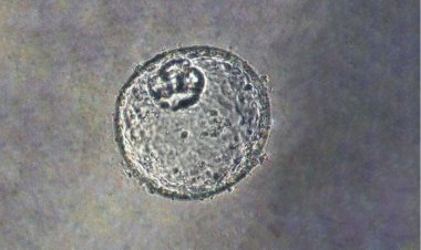 Ученые вырастили из человеческой ткани органоид для моделирования рака пищевой трубки