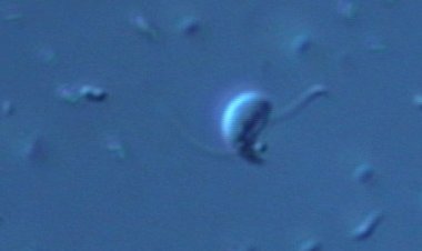 Биологи открыли новую группу микрохищников