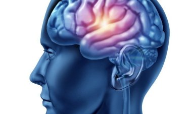 Как повреждается мозг при инсульте