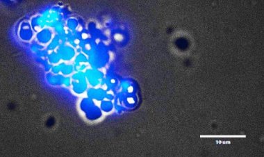 В Приэльбрусье открыт новый вид экстремофильных бактерий