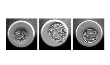 ИИ помогает определить количество хромосом у эмбриона, оплодотворенного с помощью ЭКО