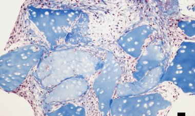 Обработка суставных хрящей свиньи ультразвуком помогла получить материал для тканевой инженерии