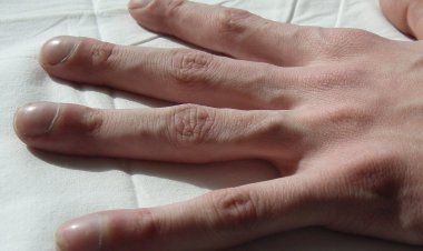 Лекарство от вызывающей "пальцы-сосиски" болезни эффективно против пневмонии