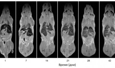 Контрастные наночастицы для МРТ тоже стареют