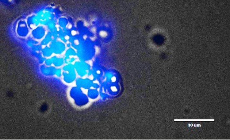 В Приэльбрусье открыт новый вид экстремофильных бактерий