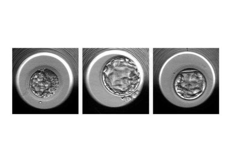 ИИ помогает определить количество хромосом у эмбриона, оплодотворенного с помощью ЭКО