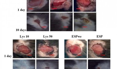 Опасный паразит печени поможет быстрее заживлять кожные раны