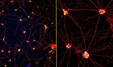 Американские ученые вырастили в лаборатории нейроны взрослого человека