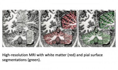 Новый метод визуализации позволил подробнее рассмотреть мозжечок