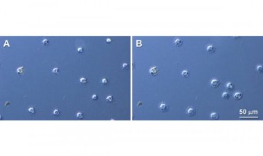 Японские ученые изучили механизм одного из самых быстрых движений клеток