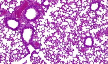 Разработано первое «живое лекарство» для лечения легочных инфекций