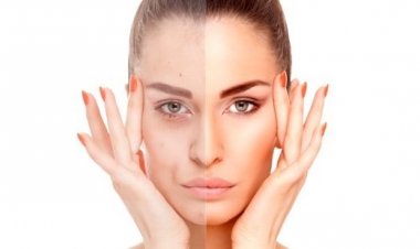 Как употребление алкоголя сказывается на лице